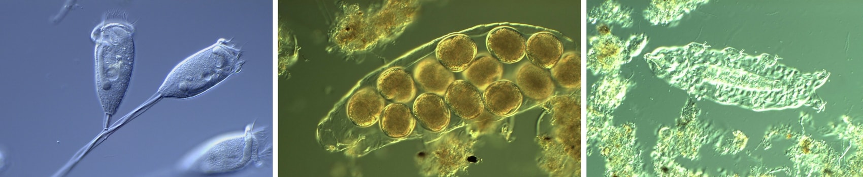 Milorganite microorganisms, microbes, bugs